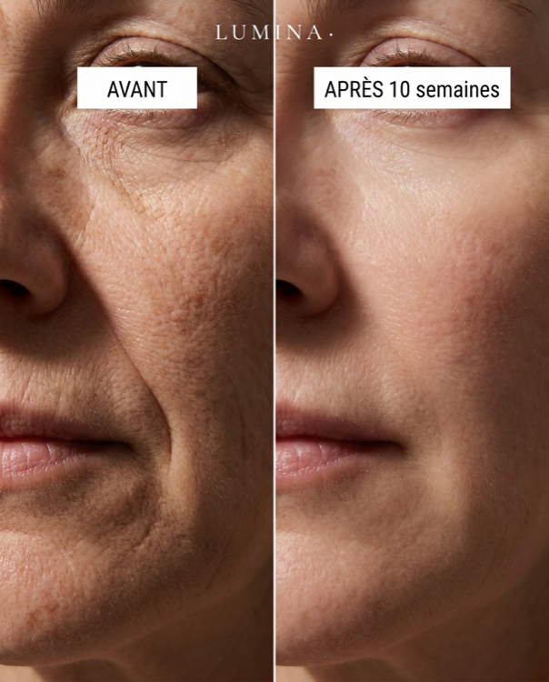 Aurélie V.